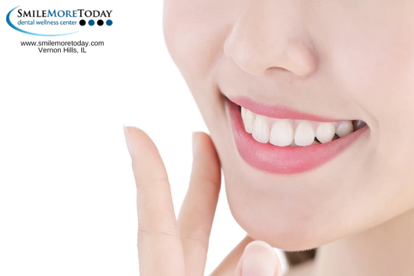 Easy Teeth Whitening at Home