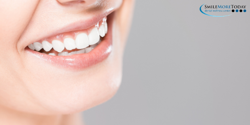 Smile makeover cosmetic dentistry