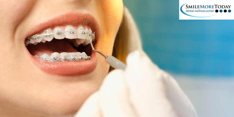 straighten teeth with orthodontics